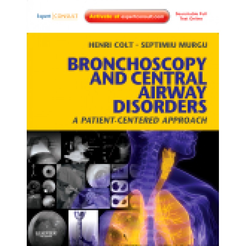 Bronchoscopy and Central Airway Disorders